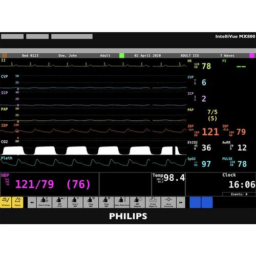 Philips IntelliVue MX800 Patient Monitor Screen Simulation for REALITi 360, 8000974, İleri Travma Yaşam Desteği (ATLS)