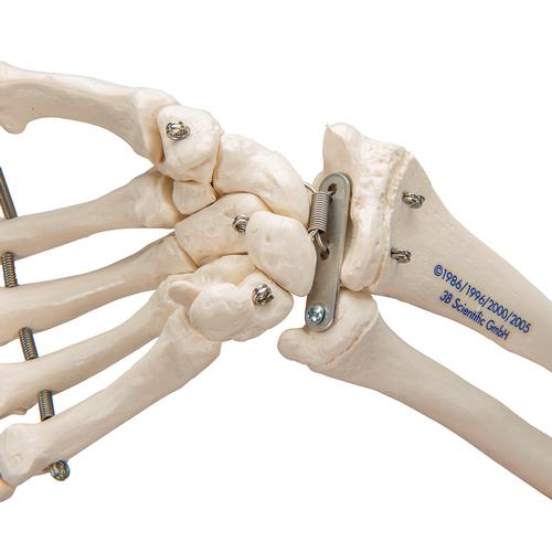 Alt kolla birlikte el iskeleti tel üzerine geçirilmiştir - 3B Smart Anatomy, 1019370 [A41], El ve kol iskelet modelleri