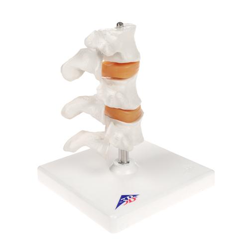 Lüks Osteoporoz Modeli (3 Omur) - 3B Smart Anatomy, 1000153 [A78], Omurga Modelleri