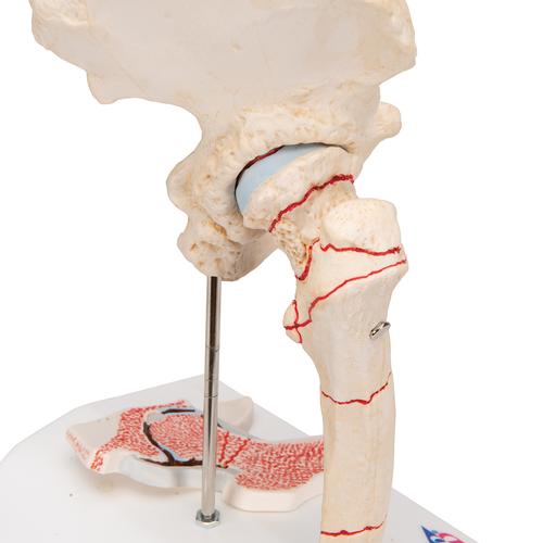Femur kırık ve kalça osteoartriti - 3B Smart Anatomy, 1000175 [A88], Eklem Modelleri