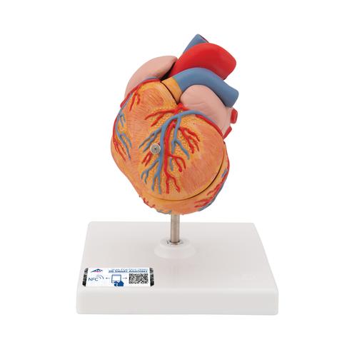 Sol Ventriküler Hipertrofi ile Klasik Kalp Modeli (LVH), 2 parçalı - 3B Smart Anatomy, 1000261 [G04], Kalp ve Dolaşım Modelleri