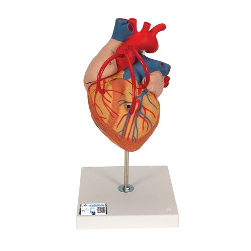 Baypaslı Kalp Modeli, 2 kat büyütülmüş, 4 parçalı - 3B Smart Anatomy, 1000263 [G06], Kalp ve Dolaşım Modelleri