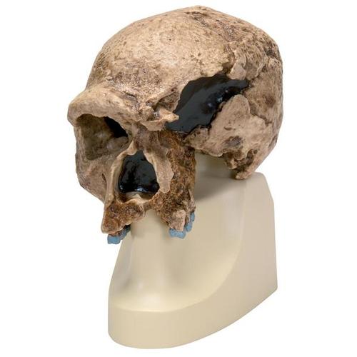 Antropolojik Kafatası - Steinheim, 1001296 [VP753/1], Antropoloji