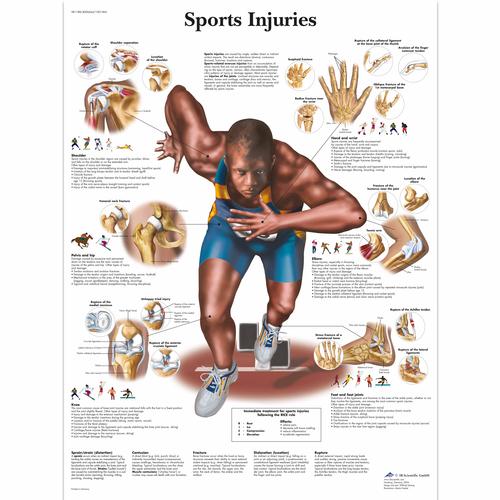 Spor Yaralanmaları Posteri, 4006664 [VR1188UU], Muscle