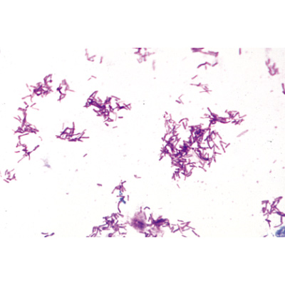 Bakteri Seti, İngilizce (25'li), 1003969 [W13040], Ingilizce