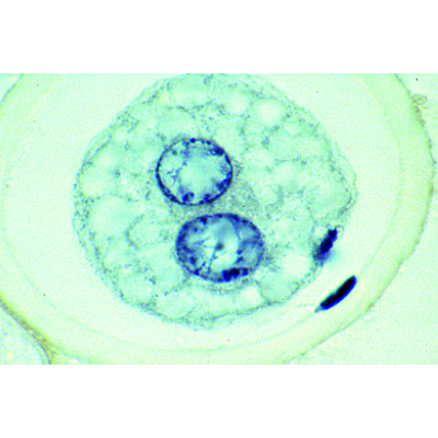 Ascaris megalocephala Embriyolojisi - Almanca, 1013478 [W13084], Hücre bölünmesi