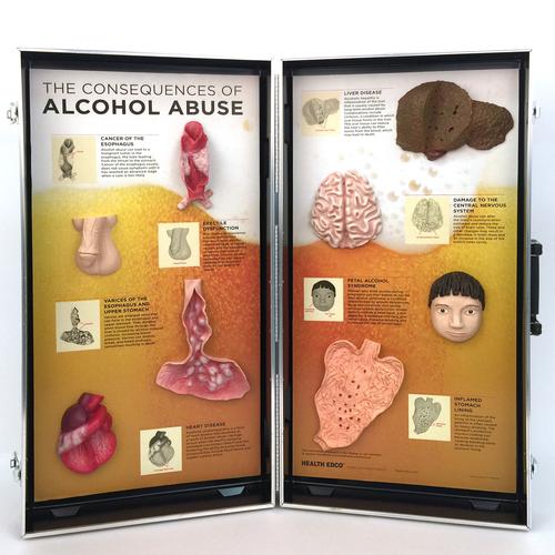 Alkol Kötüye Kullanımının Sonuçları, 3D Pano, 1005582 [W43053], Uyusturucu ve alkol bagimliligi egitimi