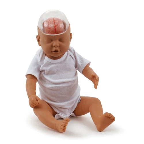 Sarsılmış Bebek Gösterim Modeli, 1017928 [W43117], Ebeveyn bilgilendirme