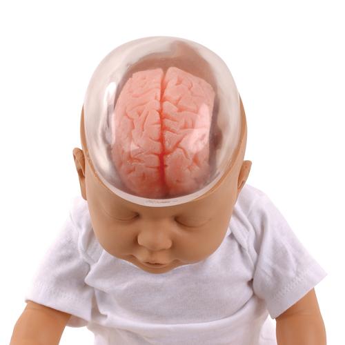 Sarsılmış Bebek Gösterim Modeli, 1017928 [W43117], Ebeveyn bilgilendirme