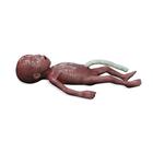 Mikro Prematüre Bebek / Aşırı Düşük Doğum Ağırlıklı Bebek (ADDA)
, 1024668, Medikal Simülatörler