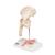 Femur kırık ve kalça osteoartriti - 3B Smart Anatomy, 1000175 [A88], Arterit ve osteoporoz (Small)