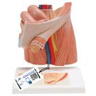 Fıtık Modeli - 3B Smart Anatomy, 1000284 [H13], Cinsel Organ ve Kalça Modelleri