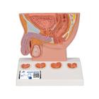 Prostat Modeli, 1/2 boyutunda - 3B Smart Anatomy, 1000319 [K41], Üriner Sistem Modelleri