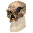 Antropolojik Kafatası - Steinheim, 1001296 [VP753/1], Antropolojik Kafatasları