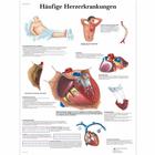 Genel Kalp Rahatsızlıkları, 4006598 [VR0343UU], Cardiovascular System