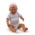 Sarsılmış Bebek Gösterim Modeli, 1017928 [W43117], Neonatal Hasta Bakımı